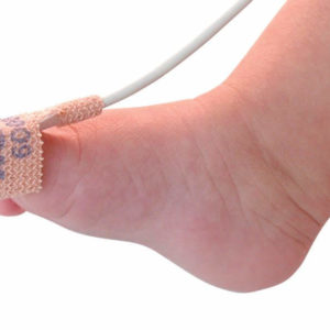 Nonin Disposable Cloth Sensors - Infant, 1m x 24